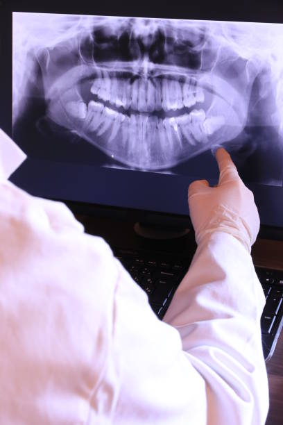 Best Emergency Wisdom Teeth Removal in Wooster, AR